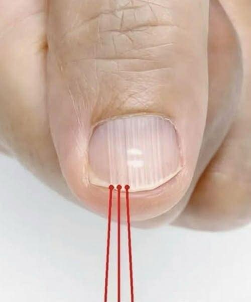 💅 Vertical Nail Ridges: Normal Changes and What They Mean for Your Nail Health