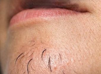 A woman’s chin hair is a sign of…See more