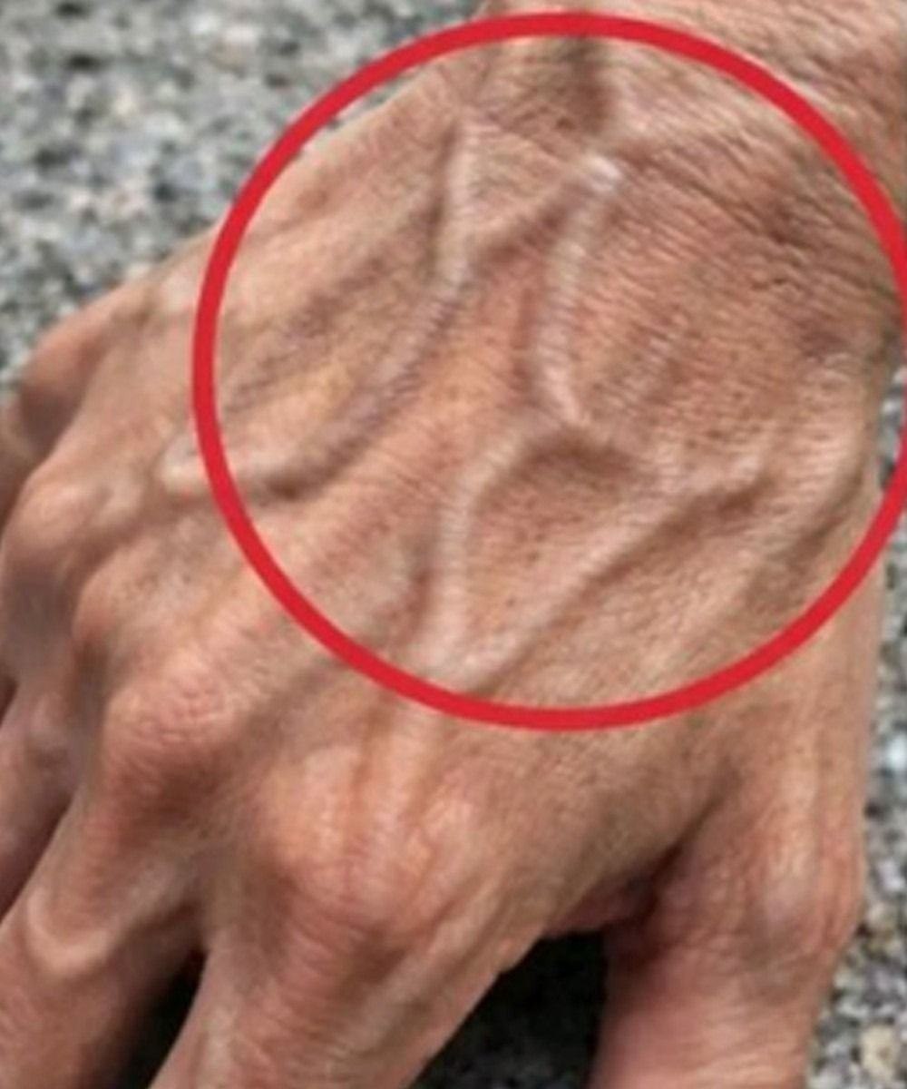If you have visible veins, it means you are… See more.
