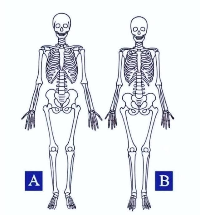 Which one is a woman???