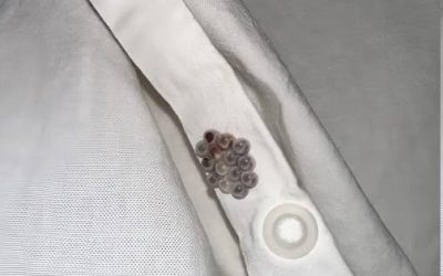 Those Tiny Balls in Your Bed? Here’s What They Really Are (And Why It’s Probably NOT Stink Bug Eggs)