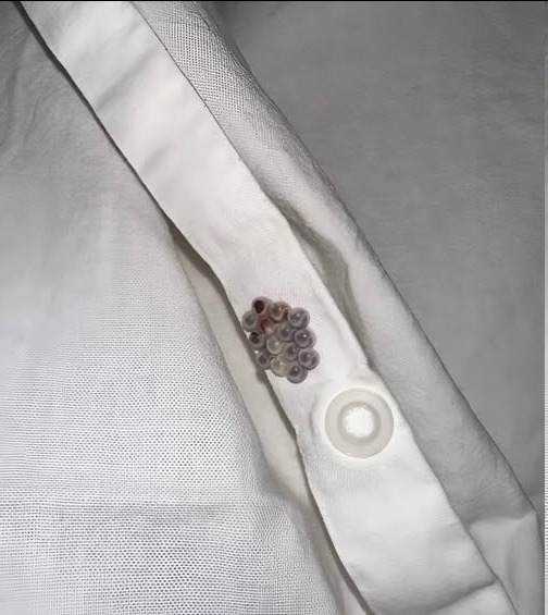 Those Tiny Balls in Your Bed? Here’s What They Really Are (And Why It’s Probably NOT Stink Bug Eggs)