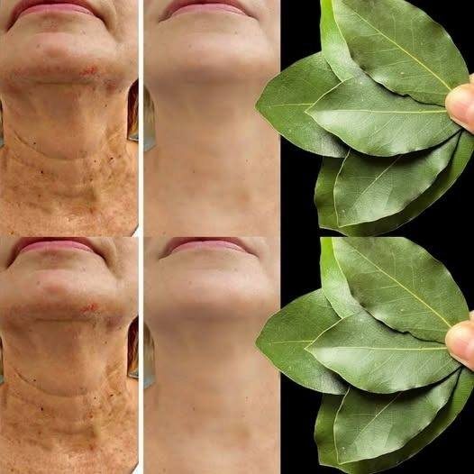 Is la folha de louro 100,000 times more powerful than Botox? | Eliminates wrinkles naturally, mesmo aos 70 anos!