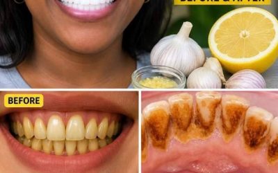 What Lemon Does to Yellow Teeth When Brushing Stops Working