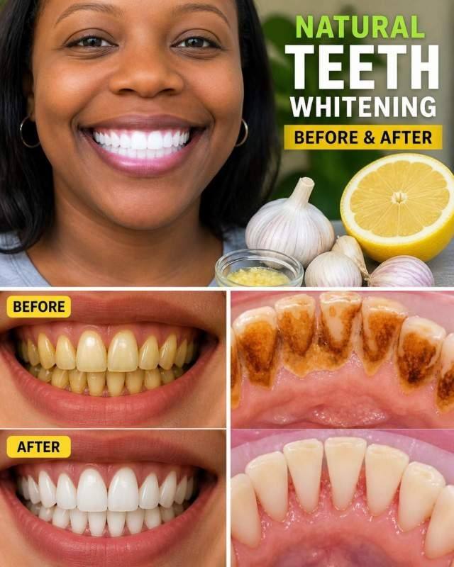 What Lemon Does to Yellow Teeth When Brushing Stops Working