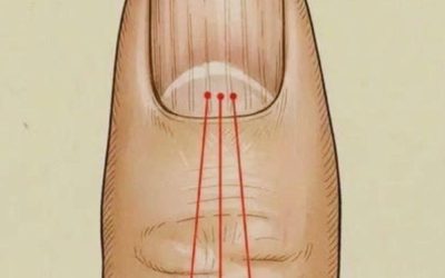 What to Eat to Reduce Nail Ridges: A Nutrition Guide for Healthier Nails