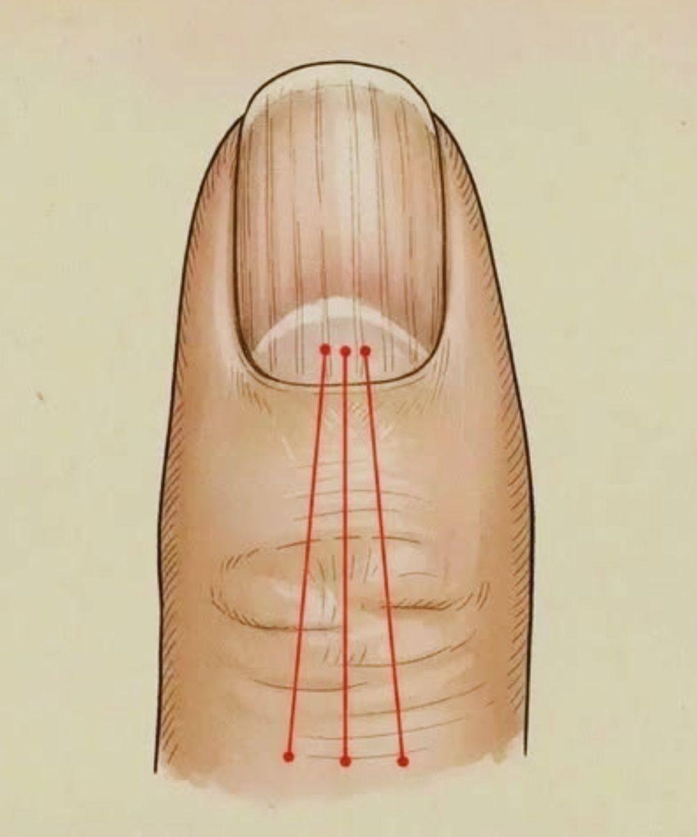 What to Eat to Reduce Nail Ridges: A Nutrition Guide for Healthier Nails