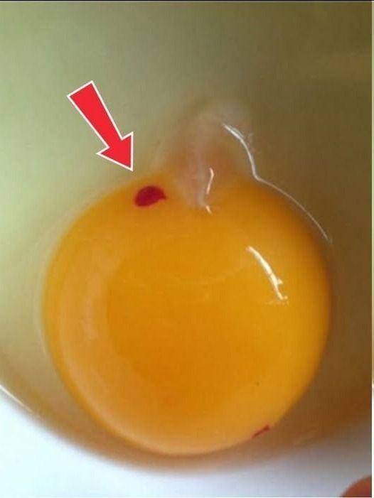 Is It Safe to Eat Eggs With Red Spots? A Clear Guide for Everyday Cooks