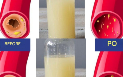 A glass of this juice every day will clear clogged arteries and regulate blood pressure – garlic, lemon and apple cider vinegar