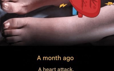 A month before a heart attack, your feet warn you of these six signs.