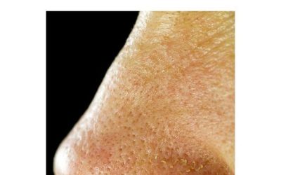 My best friend taught me this trick to clear a stuffy nose in just 5 minutes