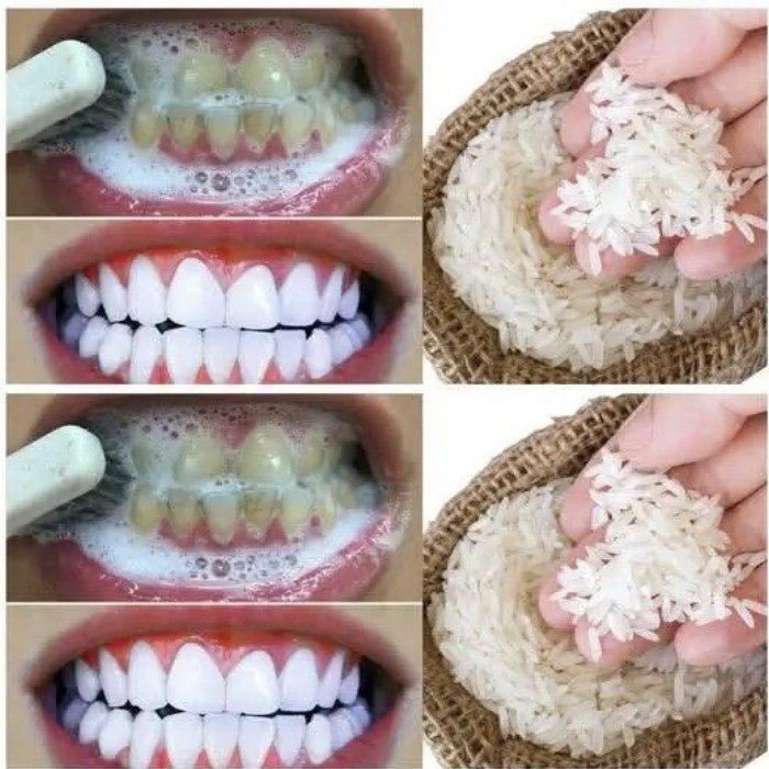 Whiten your teeth in just 1 minute with this simple home trick.👇🏼👇🏼💬