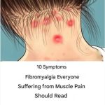 “10 Symptoms of Fibromyalgia That Everyone with Muscle Pain Should Read”