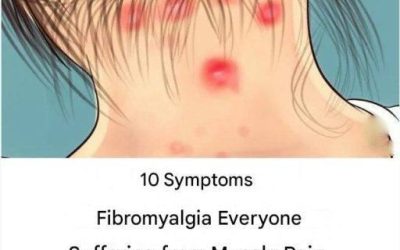 “10 Symptoms of Fibromyalgia That Everyone with Muscle Pain Should Read”