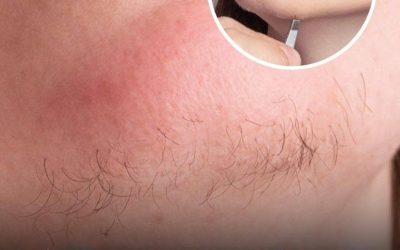 A woman’s chin hair is a sign of…See more