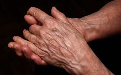 If Your Hand Veins Are Bulging or More Noticeable, Don’t Ignore These Possible Causes