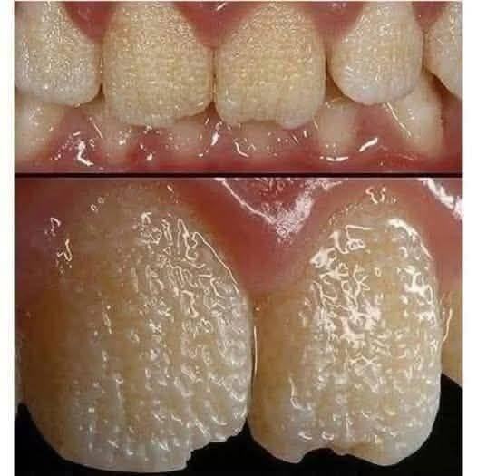 🚨 Be Careful!! This Is What Your Teeth Will Become When You Eat These Everyday Foods