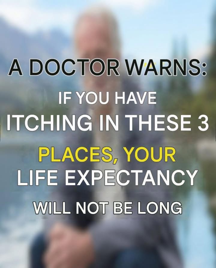 These visible signs may be hiding liver disease