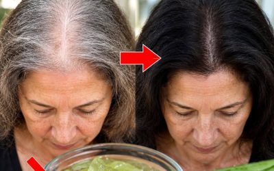 The scalp story nobody wants to admit