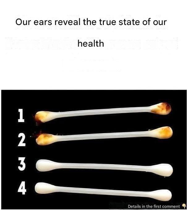 Our ears reveal the true state of our health